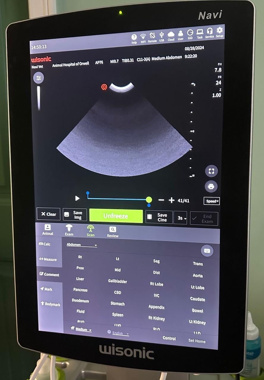 Ultrasound Image